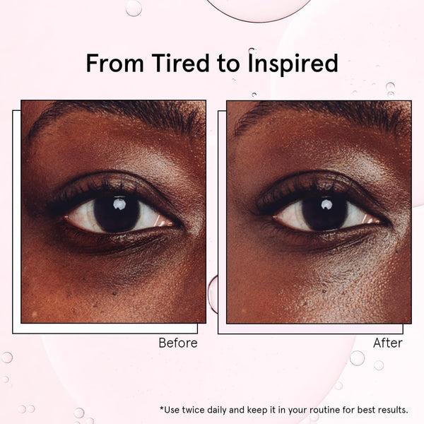 Cooling Eye Roller