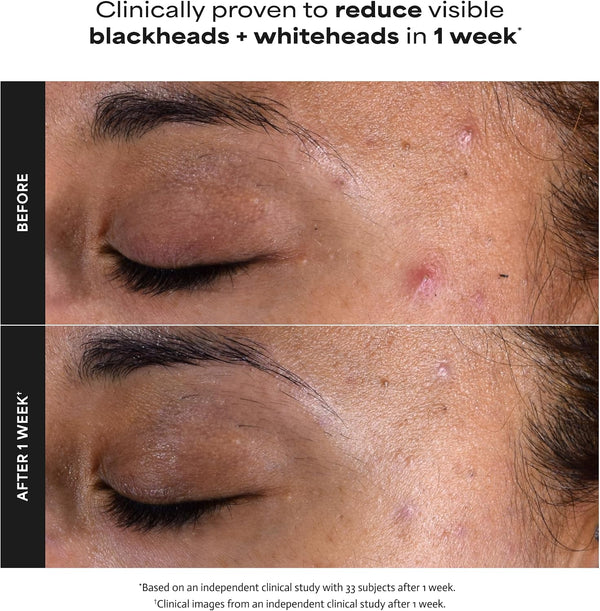 Radiant Glow BHA Exfoliant